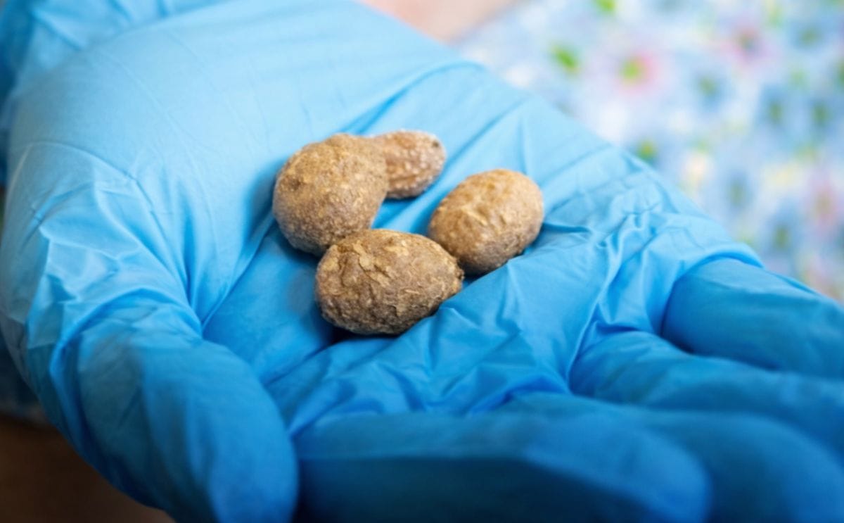 Arqueólogos encuentran las papas más antiguas de América