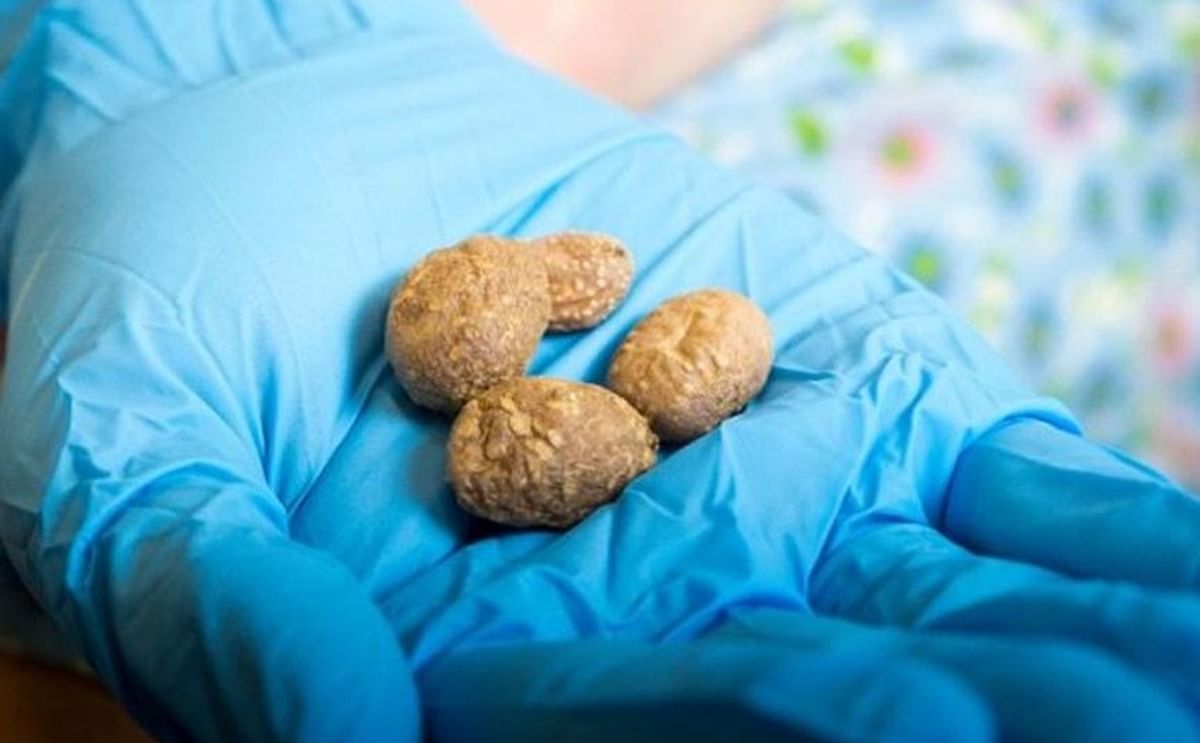 Arqueólogos encuentran las papas más antiguas de América Arqueólogos encuentran las papas más antiguas de América