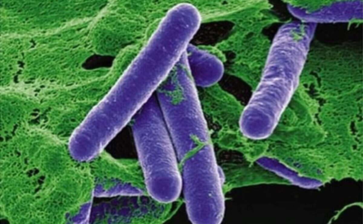 Colorized Scanning Electron Micrograph of Clostridium Botulinum. Colorized Scanning Electron Micrograph of Clostridium Botulinum.