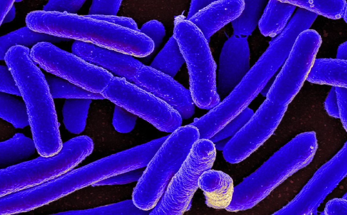 E.Coli E.Coli