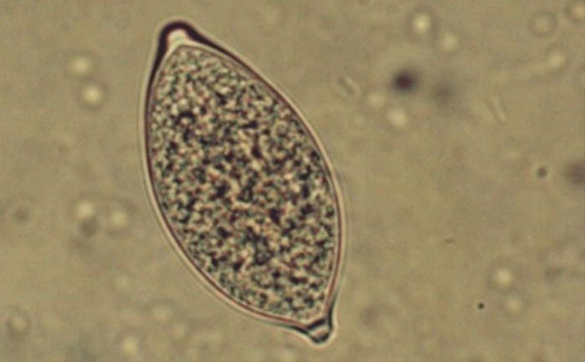 Sporenverspreiding Phytophthora Sporenverspreiding Phytophthora