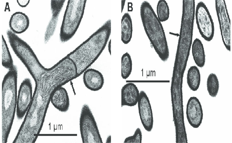 Microscopic image of *Streptomyces scabies* hyphae and spores. Microscopic image of *Streptomyces scabies* hyphae and spores.