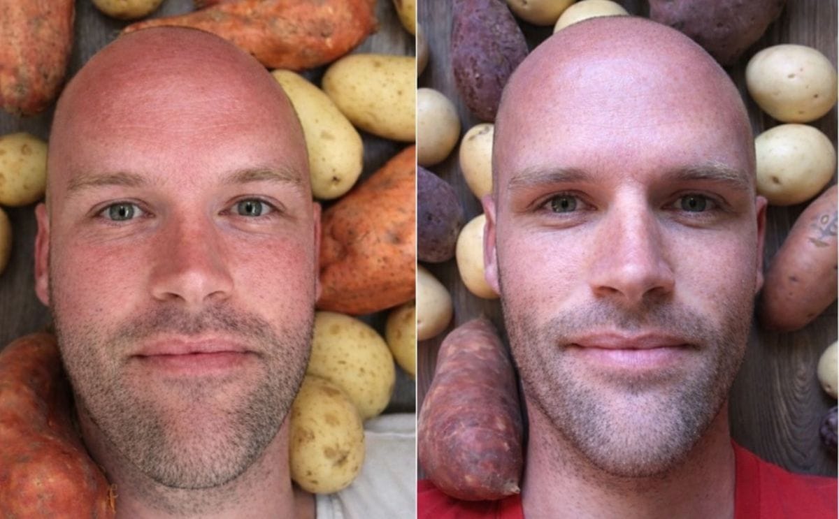 Durante un año, comió solo papas todos los días: estos son los resultados Durante un año, comió solo papas todos los días: estos son los resultados