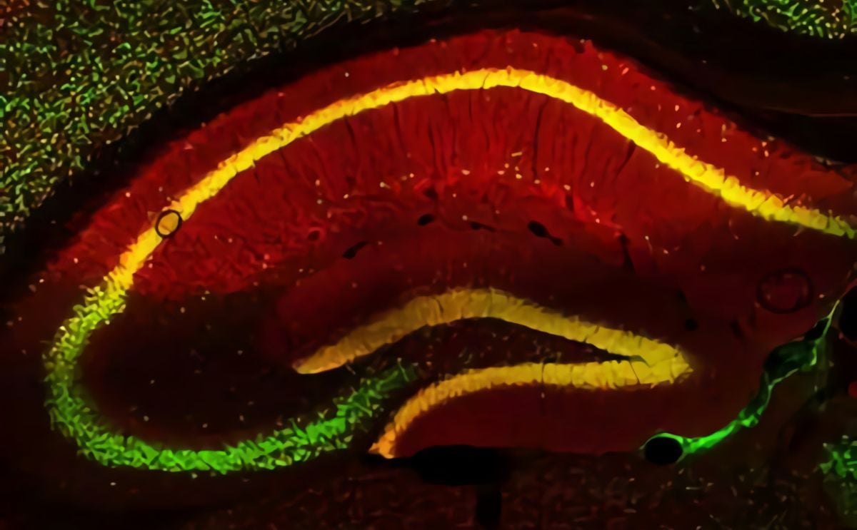 No more binge eating: signal pathway in the brain that controls food intake discovered No more binge eating: signal pathway in the brain that controls food intake discovered