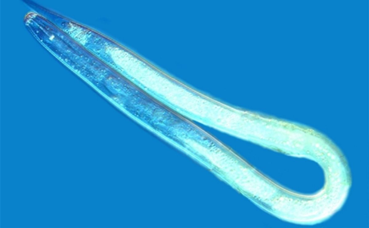 New infested acreage has been added to Idaho's pale cyst nematode program.