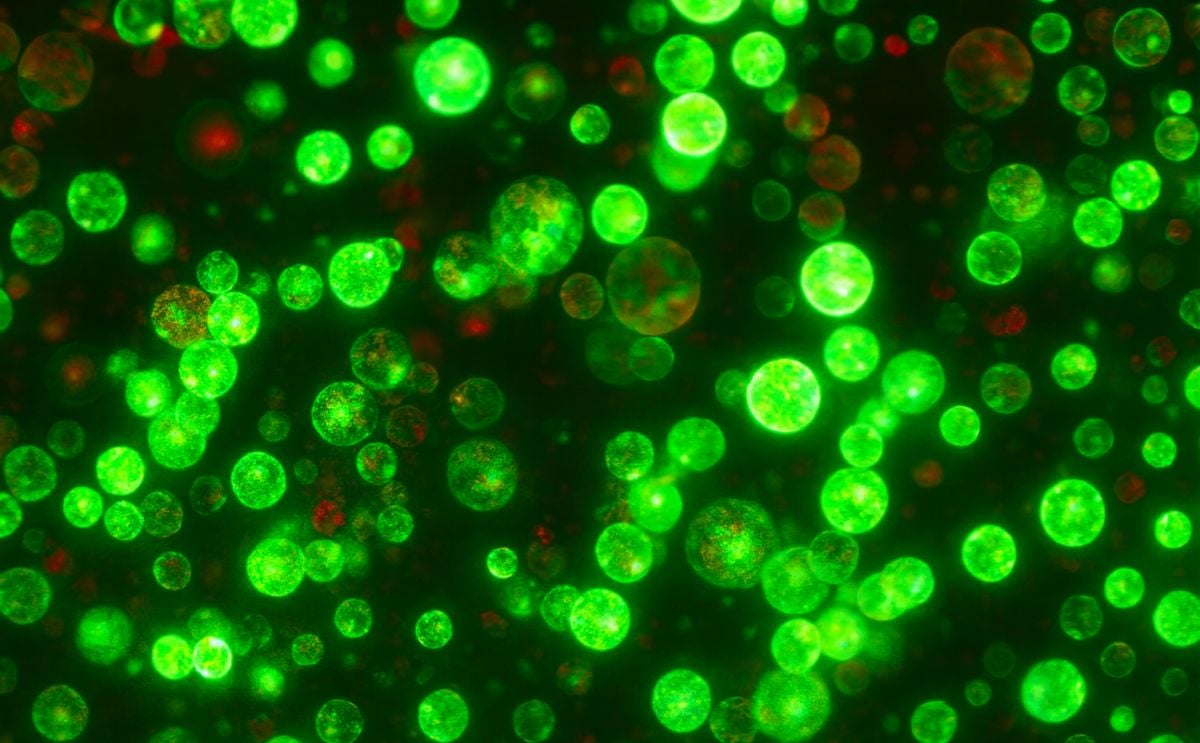 Potato protoplasts expressing green florescence to demonstrate high transformation efficiency. Potato protoplasts expressing green florescence to demonstrate high transformation efficiency.