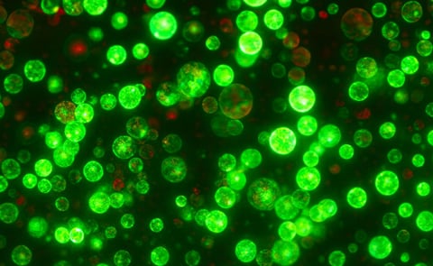 Potato protoplasts expressing green florescence to demonstrate high transformation efficiency. Potato protoplasts expressing green florescence to demonstrate high transformation efficiency.
