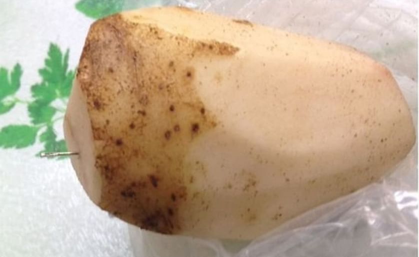 Sewing needles lodged in potatoes at Prince Edward Island french fry plant
