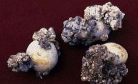 Potato wart confirmed on Prince Edward Island Potato wart confirmed on Prince Edward Island