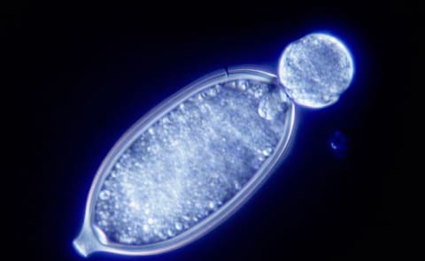 Breakthrough in understanding swarming potato blight spores Breakthrough in understanding swarming potato blight spores