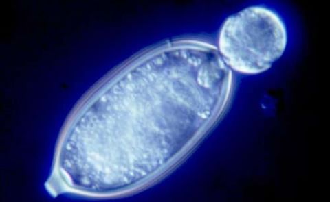 Breakthrough in understanding swarming potato blight spores Breakthrough in understanding swarming potato blight spores