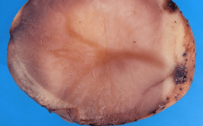 Pink rot