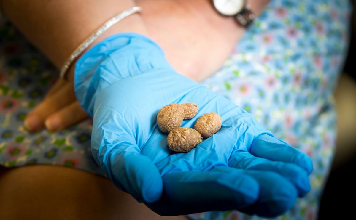 Louderback holds the tiny tubers of S. Jamesii, the Four Corners potato. University of Utah researchers discovered starch residues of this potato variety in the crevices of a 10,900-year-old stone tool in Escalante, Utah — the earliest evidence of wild 