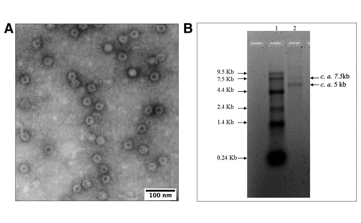 A, Virus particles visualized in the transmission electron microscope (TEM); scale bar equals 100 nm. B, Electrophoretic migration pattern of nucleic acid extracted from purified virions of the virus coded SB26/29.