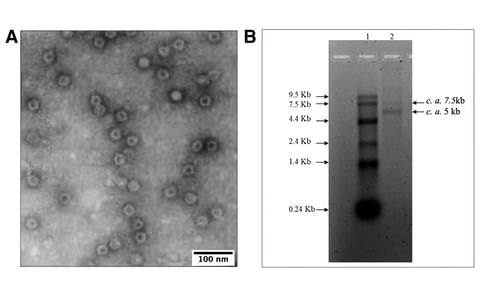 A, Virus particles visualized in the transmission electron microscope (TEM); scale bar equals 100 nm. B, Electrophoretic migration pattern of nucleic acid extracted from purified virions of the virus coded SB26/29. A, Virus particles visualized in the transmission electron microscope (TEM); scale bar equals 100 nm. B, Electrophoretic migration pattern of nucleic acid extracted from purified virions of the virus coded SB26/29.