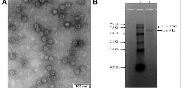 A, Virus particles visualized in the transmission electron microscope (TEM); scale bar equals 100 nm. B, Electrophoretic migration pattern of nucleic acid extracted from purified virions of the virus coded SB26/29.