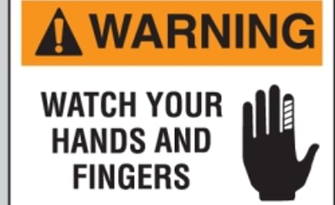 Worker loses four fingers in workplace accident Worker loses four fingers in workplace accident