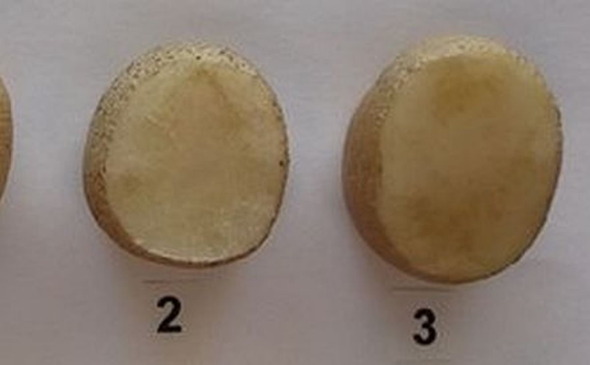 Zebra Chip symptoms 2 months after harvesting. From no symptoms (level 0) to compromised tuber (level 3).